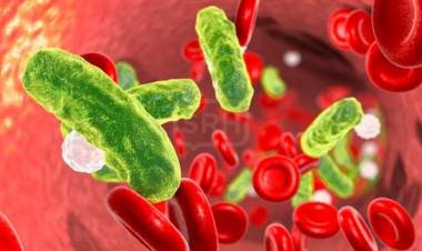 SALUD | Sepsis, qué es esta patología que produce millones de muertes en todo el mundo