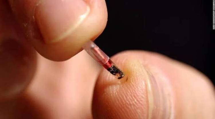 TERAPIAS HORMONALES | Cómo funciona el chip sexual que ayuda a potenciar la líbido
