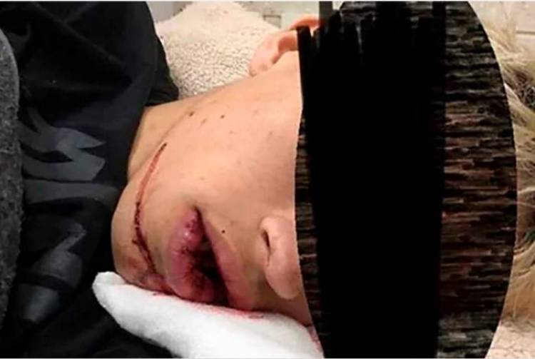 Un joven fue víctima de una golpiza salvaje a la salida de un boliche